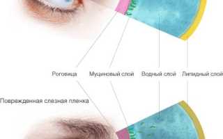 Как лечить синдром сухого глаза препараты