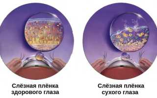 Синдром сухого глаза по утрам