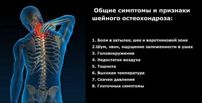 Лечение народное корешковый синдром позвоночника