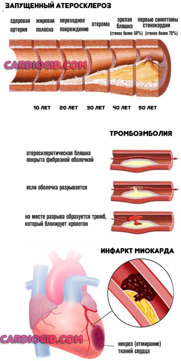 86786