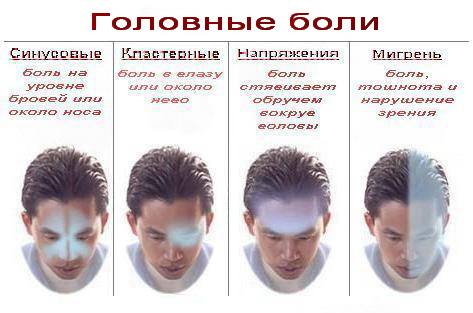 Виды головной боли
