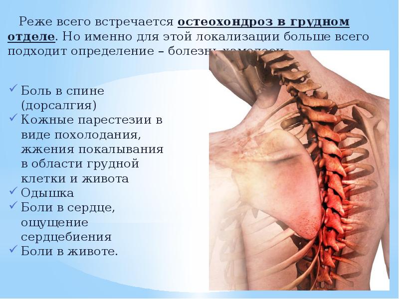 Лечение народное корешковый синдром позвоночника