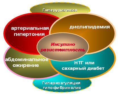 Основные звенья патогенеза метаболического синдрома