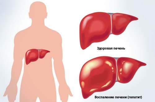 Печень при гепатите