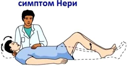 Лечение народное корешковый синдром позвоночника